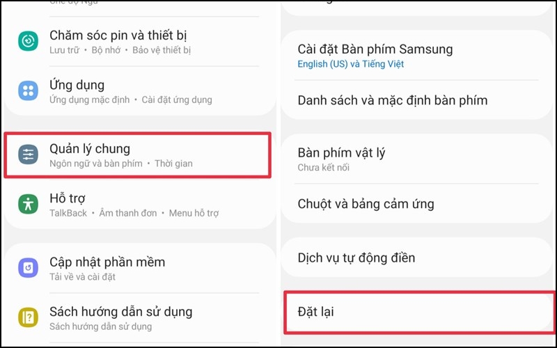 Chọn Quản lý chung rồi nhấp Đặt lạ